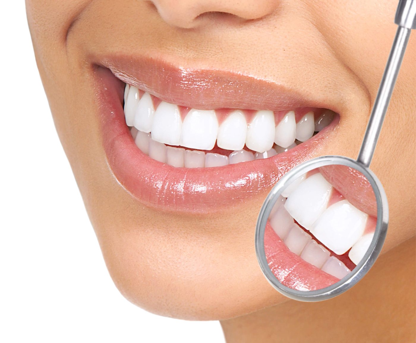 Close-up of a natural, healthy white smile being examined with a dental mirror