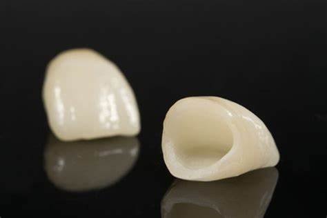 Two zirconia crowns for upper central incisors, restorative and tooth-colored