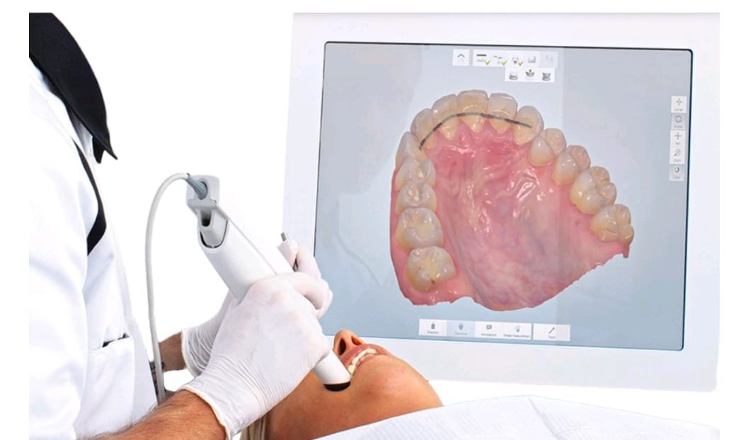 Intraoral scanner in use during a patient consultation